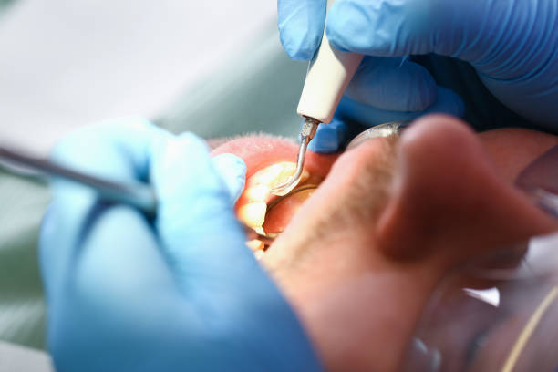 Best Urgent Tooth Repair  in , WA