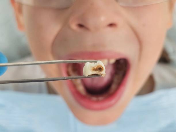 Best Broken Tooth Emergency  in , WA